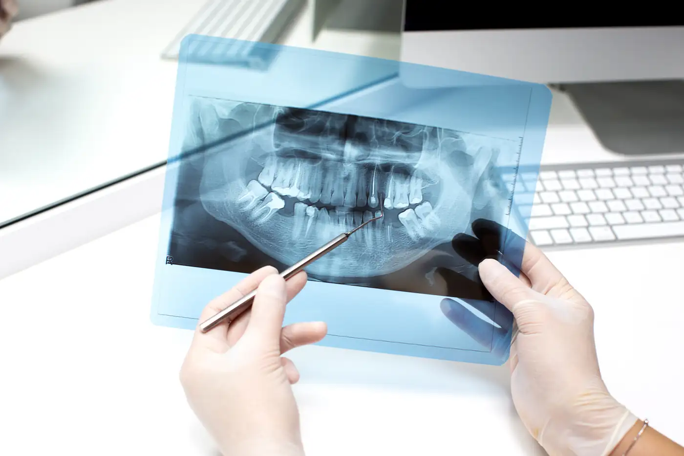 Equipo realizando cirugía dental