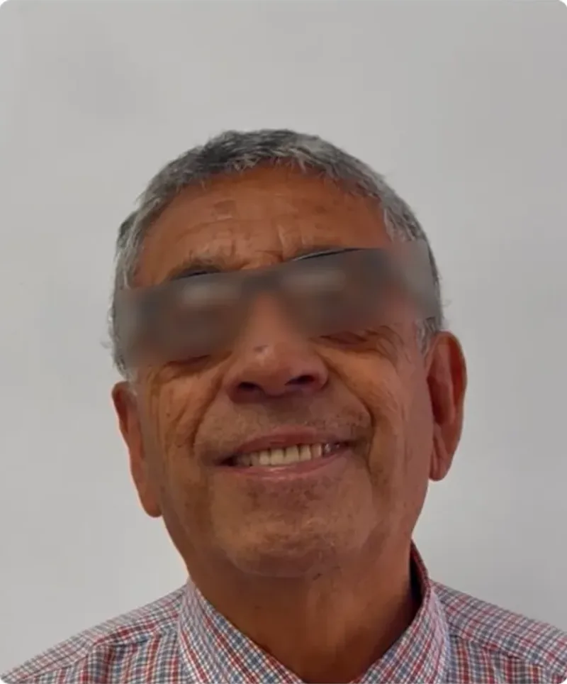 El mismo paciente sonriendo tras el tratamiento periodontal y la rehabilitación con prótesis
